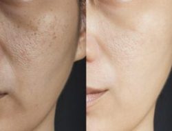 Jangan Remehkan! Rahasia 4 Langkah Skincare untuk Kulit Cerah Merata